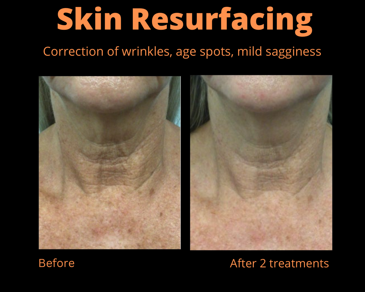 Cosmetic Treatment Leesburg FL