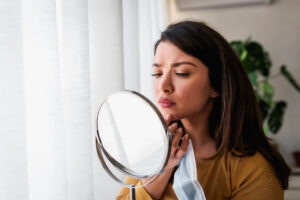 Woman looking in the mirror at her acne in Leesburg, FL