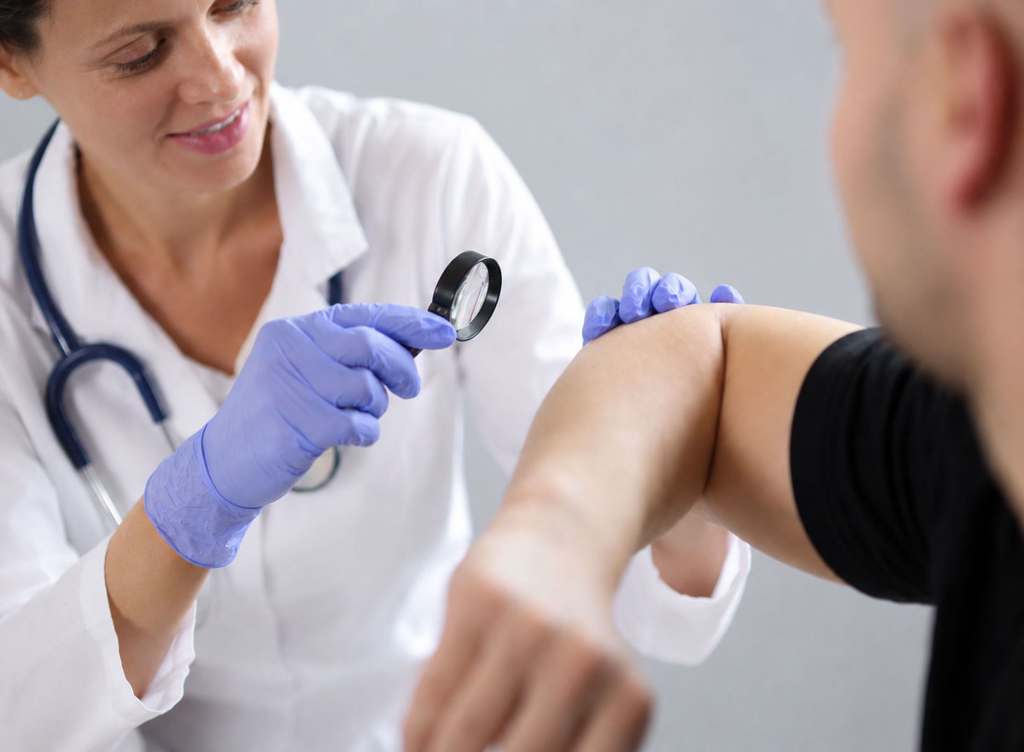 Doctor examining wart for treatment in Leesburg, FL