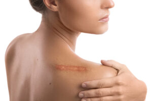 Woman with scar on her back in Leesburg, FL
